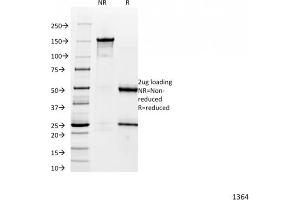 SDS-PAGE Analysis Purified Catenin, alpha-1 Mouse Monoclonal Antibody (1G5). (CTNNA1 抗体)