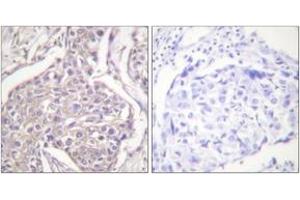 Immunohistochemistry (IHC) image for anti-Heat Shock Protein, alpha-Crystallin-Related, B6 (HSPB6) (AA 5-54), (pSer16) antibody (ABIN1531324)