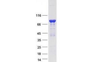 Caldesmon 1 (CALD1) (Transcript Variant 3) protein (Myc-DYKDDDDK Tag)