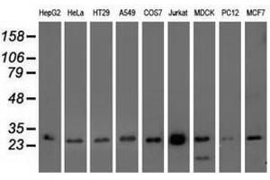 Image no. 3 for anti-OTU Domain, Ubiquitin Aldehyde Binding 2 (OTUB2) antibody (ABIN1499938) (OTUB2 抗体)