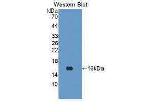 Western blot analysis of the recombinant protein. (Interferon gamma 抗体  (AA 24-166))