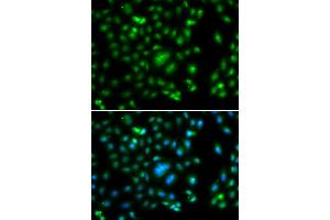 Immunofluorescence analysis of A549 cells using ELF5 antibody (ABIN5974316).