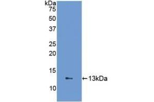 Detection of Recombinant FABP1, Human using Polyclonal Antibody to Fatty Acid Binding Protein 1 (FABP1) (FABP1 抗体  (AA 2-127))
