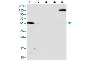 Western blot analysis of Lane 1: RT-4, Lane 2: U-251 MG, Lane 3: Human Plasma, Lane 4: Liver, Lane 5: Tonsil with OSBPL2 polyclonal antibody  at 1:100-1:250 dilution. (OSBPL2 抗体)