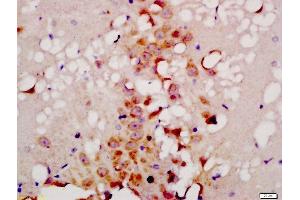 Formalin-fixed and paraffin embedded rat brain labeled with Anti-TG9B Polyclonal Antibody, Unconjugated  at 1:200 followed by conjugation to the secondary antibody and DAB staining (ATG9B 抗体  (AA 351-450))