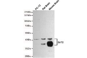 Western blot detection of SirT2 in PC-12, Rat Brain and Mouse Brain cell lysates using SirT2 mouse mAb (1:1000 diluted). (SIRT2 抗体)