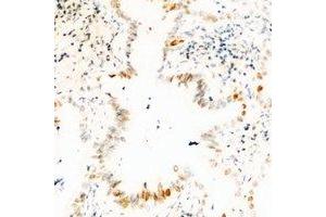 Immunohistochemical analysis of USP36 staining in human kidney formalin fixed paraffin embedded tissue section. (USP36 抗体)