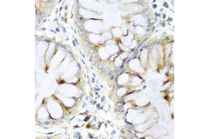 Immunohistochemistry of paraffin-embedded human colon using PI3 antibody at dilution of 1:100 (40x lens). (PI3 抗体)