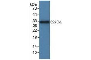 Detection of Recombinant ITGaD, Rat using Polyclonal Antibody to Integrin Alpha D (ITGaD) (ITGAD 抗体  (AA 879-1099))