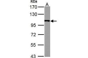 WB Image alpha Actinin 4 antibody [C2C3], C-term detects ACTN4 protein by Western blot analysis. (alpha Actinin 4 抗体  (C-Term))
