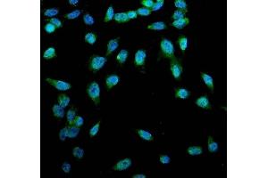 IF analysis of ACSL1 using anti-ACSL1antibody (ABIN4886418). (ACSL1 抗体  (AA 604-698))