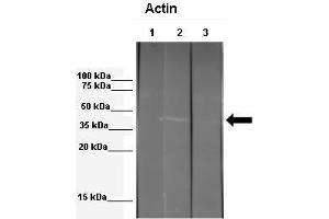 WB Suggested Anti-ACTB Antibody  Positive Control: Lane 1: 341 µg mouse 3T3 ECM extract + blocking peptide, Lane 2: 041 µg mouse 3T3 ECM extract, Lane 3: 041 µg Echinococcus granulosus extract Primary Antibody Dilution: 1:000Secondary Antibody: Anti-rabbit-HRP Secondry  Antibody Dilution: 1:00,000Submitted by: Anonymous (beta Actin 抗体  (Middle Region))