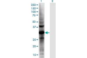 Western Blot analysis of AKR1CL2 expression in transfected 293T cell line by AKR1CL2 monoclonal antibody (M02), clone 1C8. (AKR1E2 抗体  (AA 1-307))