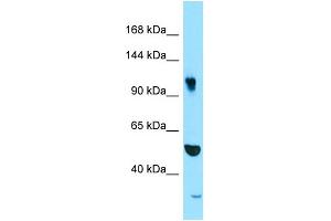 WB Suggested Anti-SYNRG Antibody Titration: 1.