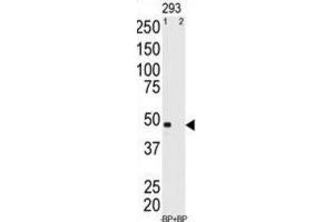 Western Blotting (WB) image for anti-Melanoma Antigen Family A, 11 (MAGEA11) antibody (ABIN3002529) (MAGEA11 抗体)