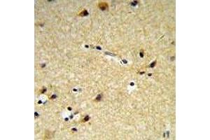 Immunohistochemistry (IHC) image for anti-Cytochrome P450, Family 26, Subfamily A, Polypeptide 1 (CYP26A1) (AA 467-497) antibody (ABIN3030691)
