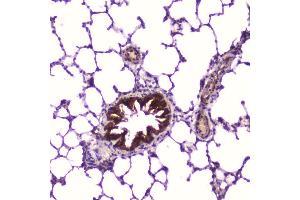 IHC analysis of IGFBP2 using anti-IGFBP2 antibody (ABIN5693239).