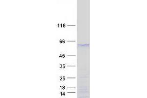 Western Blotting (WB) image for SRY (Sex Determining Region Y)-Box 17 (SOX17) protein (Myc-DYKDDDDK Tag) (ABIN2732447)