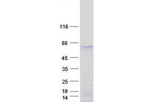 Validation with Western Blot (SOX17 Protein (Myc-DYKDDDDK Tag))