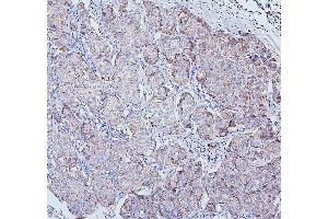 IHC analysis of TRPV3 using anti-TRPV3 antibody (ABIN7601087).