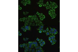 Immunofluorescence analysis of HeLa cells using ECHS1 antibody. (ECHS1 抗体  (AA 28-290))