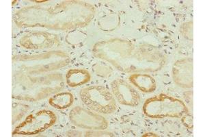 Immunohistochemistry of paraffin-embedded human kidney tissue using ABIN7173949 at dilution of 1:100 (TWIST2 抗体  (AA 1-70))