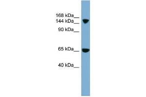 WB Suggested Anti-SLC4A5 Antibody Titration:  0. (NBC4 抗体  (Middle Region))