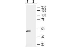Western blot analysis of rat dorsal root ganglia lysates: - 1. (STOML1 抗体  (Extracellular, N-Term))