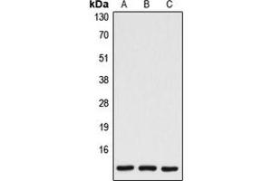 Western blot analysis of Caspase 7 p11 expression in HEK293T (A), mouse spleen (B), rat spleen (C) whole cell lysates. (Caspase 7 p11 (Center) 抗体)