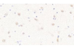 Detection of MAP2K4 in Human Cerebrum Tissue using Polyclonal Antibody to Mitogen Activated Protein Kinase Kinase 4 (MAP2K4) (MAP2K4 抗体  (AA 137-394))