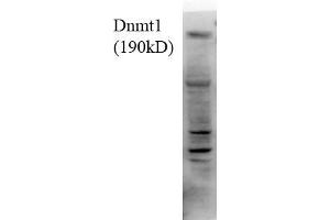Dnmt1, 18ug H1299 lysate 1 in1000 Western Blotting. (DNMT1 抗体  (AA 620-950))