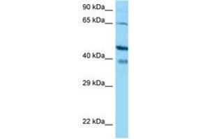 Image no. 1 for anti-S100 Calcium Binding Protein G (S100G) (AA 108-157) antibody (ABIN6748472) (S100G 抗体  (AA 108-157))