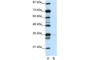 WB Suggested Anti-NANOG Antibody   Titration: 1. (Nanog 抗体  (N-Term))