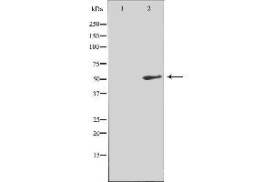 Western blot analysis of extracts from COLO205 cells, using NK3R antibody. (TACR3 抗体  (C-Term))