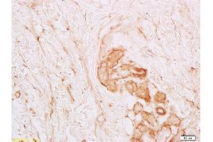 Immunohistochemistry (Paraffin-embedded Sections) (IHC (p)) image for anti-Collagen, Type VI, alpha 1 (COL6A1) (AA 951-1028) antibody (ABIN670011)