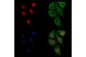 ABIN6256541 and ABIN6267174 staining heat-shock treated Hela cells by IF/ICC. (SF3B1 抗体  (pThr313))