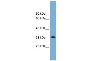 WB Suggested Anti-MRPS2 Antibody Titration: 0. (MRPS2 抗体  (Middle Region))