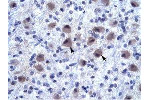 Image no. 1 for anti-Ring Finger Protein 141 (RNF141) (AA 96-145) antibody (ABIN6735889) (RNF141 抗体  (AA 96-145))