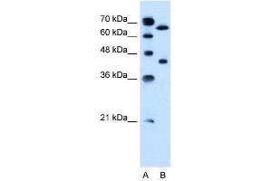 Lane A: Marker Lane B: Jurkat Cell Lysate (SLCO1A2 抗体  (AA 201-250))