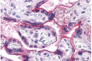 Human Placenta: Formalin-Fixed, Paraffin-Embedded (FFPE) (CDC16 抗体  (N-Term))