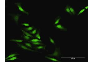 Immunofluorescence of purified MaxPab antibody to STAU2 on HeLa cell. (Double-stranded RNA-binding protein Staufen homolog 2 (STAU2) (AA 1-479) 抗体)