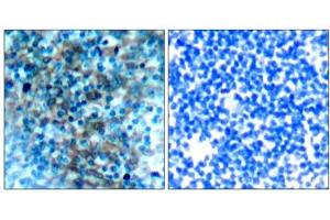 Immunohistochemical analysis of paraffin-embedded human tonsil carcinoma tissue, using VASP (Ab-238) antibody (E021172). (VASP 抗体)