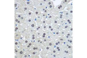 Immunohistochemistry of paraffin-embedded Rat liver using UB antibody (2359) at dilution of 1:100 (40x lens). (UBA1 抗体  (AA 300-600))