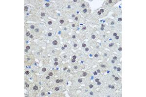 Immunohistochemistry of paraffin-embedded Rat liver using UB antibody (2359) at dilution of 1:100 (40x lens). (UBA1 抗体  (AA 300-600))