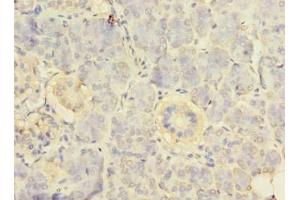 Immunohistochemistry of paraffin-embedded human pancreatic tissue using ABIN7142524 at dilution of 1:100 (RPS24 抗体  (AA 2-133))