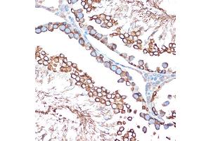 Immunohistochemistry (IHC) image for anti-Activin A Receptor, Type IB (ACVR1B) antibody (ABIN1678826)
