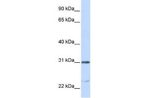 Western Blotting (WB) image for anti-Nucleolar and Spindle Associated Protein 1 (NUSAP1) antibody (ABIN2459000)