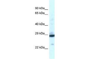 WB Suggested Anti-PGAM1 Antibody Titration: 1. (PGAM1 抗体  (C-Term))