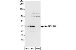 anti-Mitogen-Activated Protein Kinase 1 Interacting Protein 1-Like (MAPK1IP1L) (AA 195-245) antibody