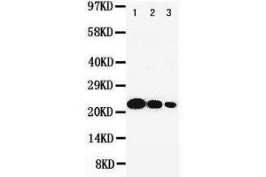 Anti-IL6 antibody, Western blotting Lane 1: Recombinant Human IL-6 Protein 10ng Lane 2: Recombinant Human IL-6 Protein 5ng Lane 3: Recombinant Human IL-6 Protein 2. (IL-6 抗体  (C-Term))